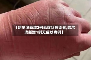 【哈尔滨新增2例无症状感染者,哈尔滨新增1例无症状病例】